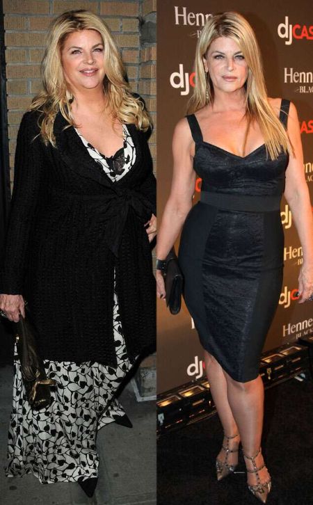 Kirstie Alley's before and after picture.